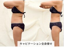 トレゾール(tresor)/【痩身】赤坂痩身エステtresor