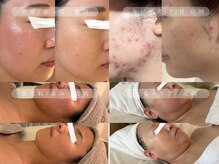 フォー(For...)の雰囲気（肌質改善特化サロン|結果重視！豊富なピーリングで効果実感◎）