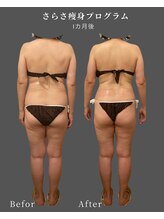 ナチュラル ビューティー スタイル さらさ(Natural Beauty Style)/50代☆1カ月後