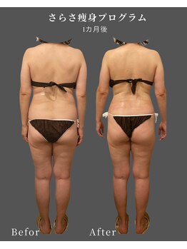 ナチュラル ビューティー スタイル さらさ(Natural Beauty Style)/50代☆1カ月後