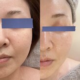 リッチベル(richbelle)