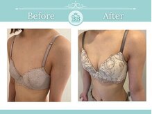 美人バスト 新潟店/ 【バストアップ★育乳】症例