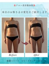 アロハ美容整体院 花巻店/肩こり改善★リリースカッター