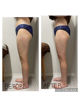 エンチャント(ENCHANT)/脚長効果！　太もも、お尻ケア！