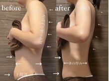 マルレ 三軒茶屋(MARLE)/悩み:凝りとぽっこりお腹