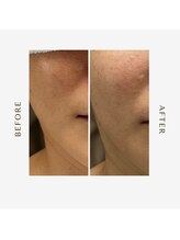 オーシャン(OCEAN)/大阪からご来店お客様