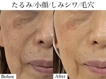 お顔の印象の雰囲気（小顔＆肌質改善◎毛穴/フェイシャル/シミケア/リンパ/吉祥寺）