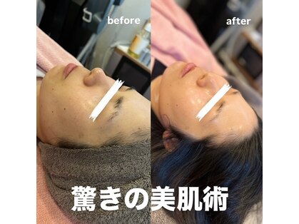 リリアン(Rilian)の写真