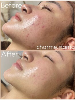 シャルム(Charme.)/