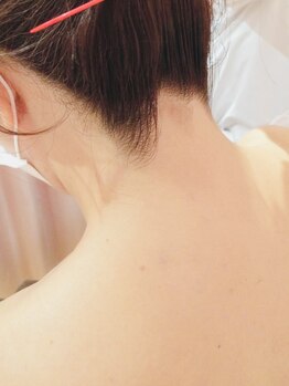 ピエル(Piel)の写真/【特別な日を迎える前に★】美しく輝いたドレス姿の為のサポートを♪誰もが見惚れるツヤ美肌へ！