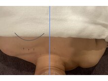 ハイナ 恵比寿店(Hi-Na)/恵比寿/フェイシャル/ブライダル