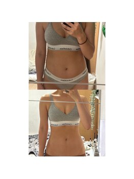 パルティール 銀座店 partir/8ヶ月の効果！【痩身】【銀座】