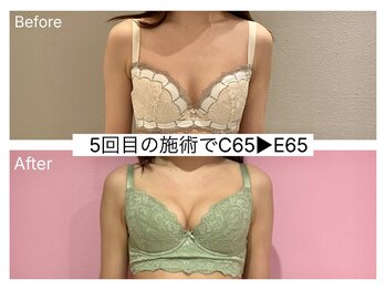 ククナ 新潟本店(KUKUNA)/*バストアップケア*