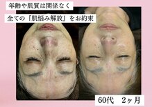 シェリートーキョー 成田店(Cherie Tokyo)