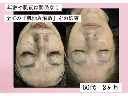 シェリートーキョー 成田店(Cherie Tokyo)の写真