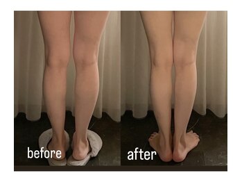 サロン ド プリヴェ(Salon de PRIVE)/隠れO脚ケア!浮腫みケア!美尻