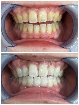 シャイニー 仙台駅東口(SHINY)/お客様の変化