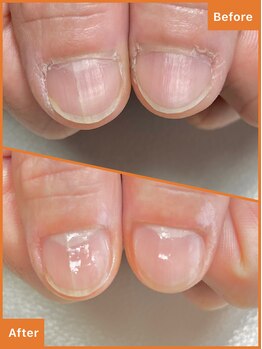 ワイ(Y)/べったり甘皮