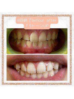 ワイズサロン(Y's salon)/8回終了のbefour after