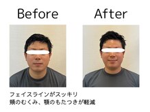 オリナ(olina)/-before & after-