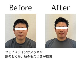 オリナ(olina)/-before & after-