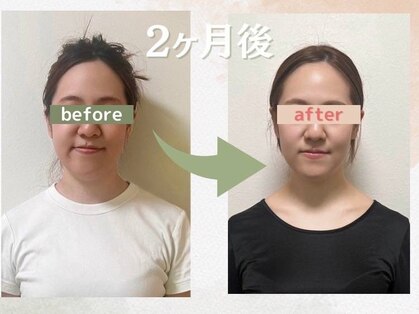 ククナ(KUKUNA)の写真