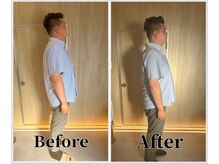 整体ラルース 中目黒(LALUZ)/30代　男性　猫背、姿勢改善