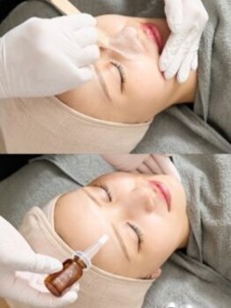 顔脱毛がしたい