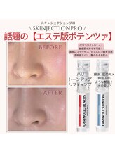 エイミー 名古屋駅前店(eimy.)/ハーブピーリング/名古屋