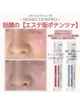 エイミー 名古屋駅前店(eimy.)/ハーブピーリング/名古屋