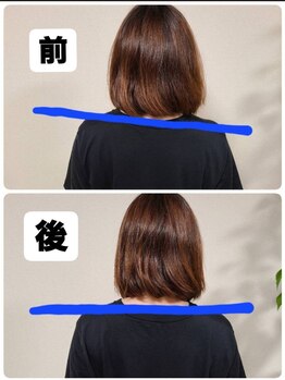 下村治療院/ビフォーアフター