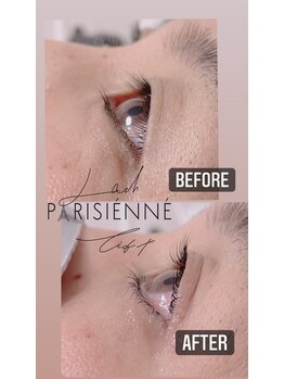 ベルグレン(Belleglen)/