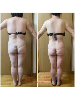 フィカス(FICUS)/モニター様