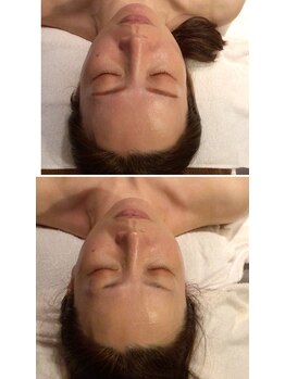 クレビア 神保町 水道橋(CREBIA)/フェイシャル/痩身サロン