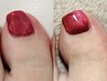 【Foot】巻き爪ケア専用ジェルお試し1本¥3000