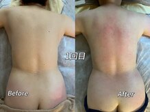 メイ 葛西(Mei)/背中集中ケアで変化実感