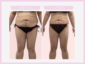 スリムライン 弘前店(The Slim Line)/before→after