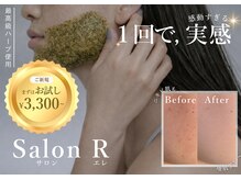 アール(R)