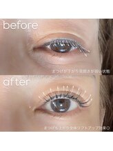 ビューティーグロウ(BEAUTY-GROW)/
