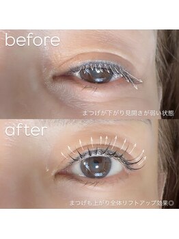 ビューティーグロウ(BEAUTY-GROW)/
