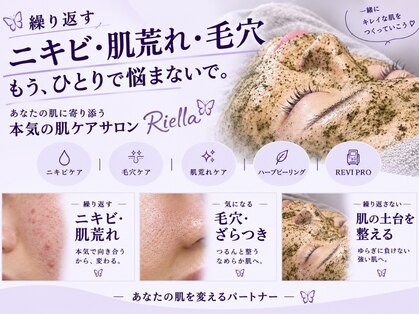 リエラ(Riella)の写真