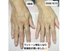 ネイルサロンカリプソ(Nail Salon Calypso 2)の雰囲気（ジェルネイル施術と同時に【手の再生美容コース♪】）
