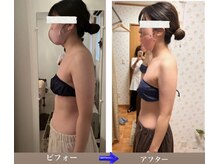 ミーシェ(Meshine)の雰囲気（挙式前のブライダルエステもお任せ！メニューも豊富で人気です！）