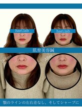 ハリラボ(hari Lab.)/【お客様の声】