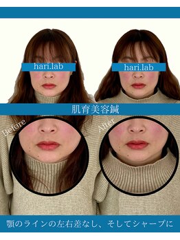 ハリラボ(hari Lab.)/【お客様の声】