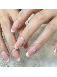 カラグラ+フレンチ