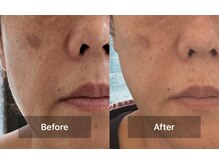 ウェリナベル(WelinaBelle)の雰囲気（韓国美容で注目のララピール毛穴・ニキビケア・シミシワケア）