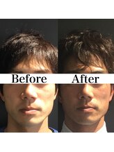 リフェイス(Re:face)/定期的ケアで男前のモテ顔に変化
