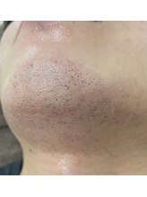 カルディエ(Cardie)/ポップアップ現象