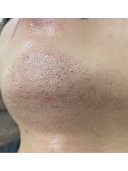 カルディエ(Cardie)/ポップアップ現象